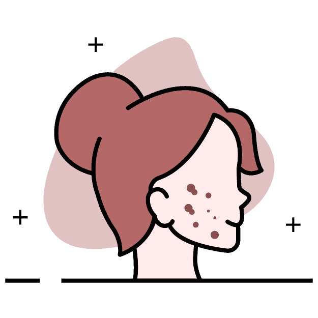 ícono de una mujer con acne en el rostro.