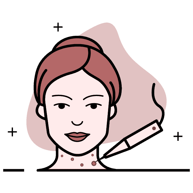 ícono de remoción de verrugas.